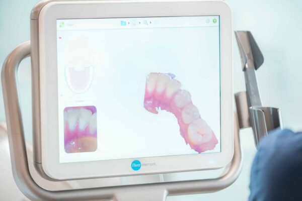 Technology-Smiles-By-The-Bay-Annapolis-MD-Orthodontics-2021_16