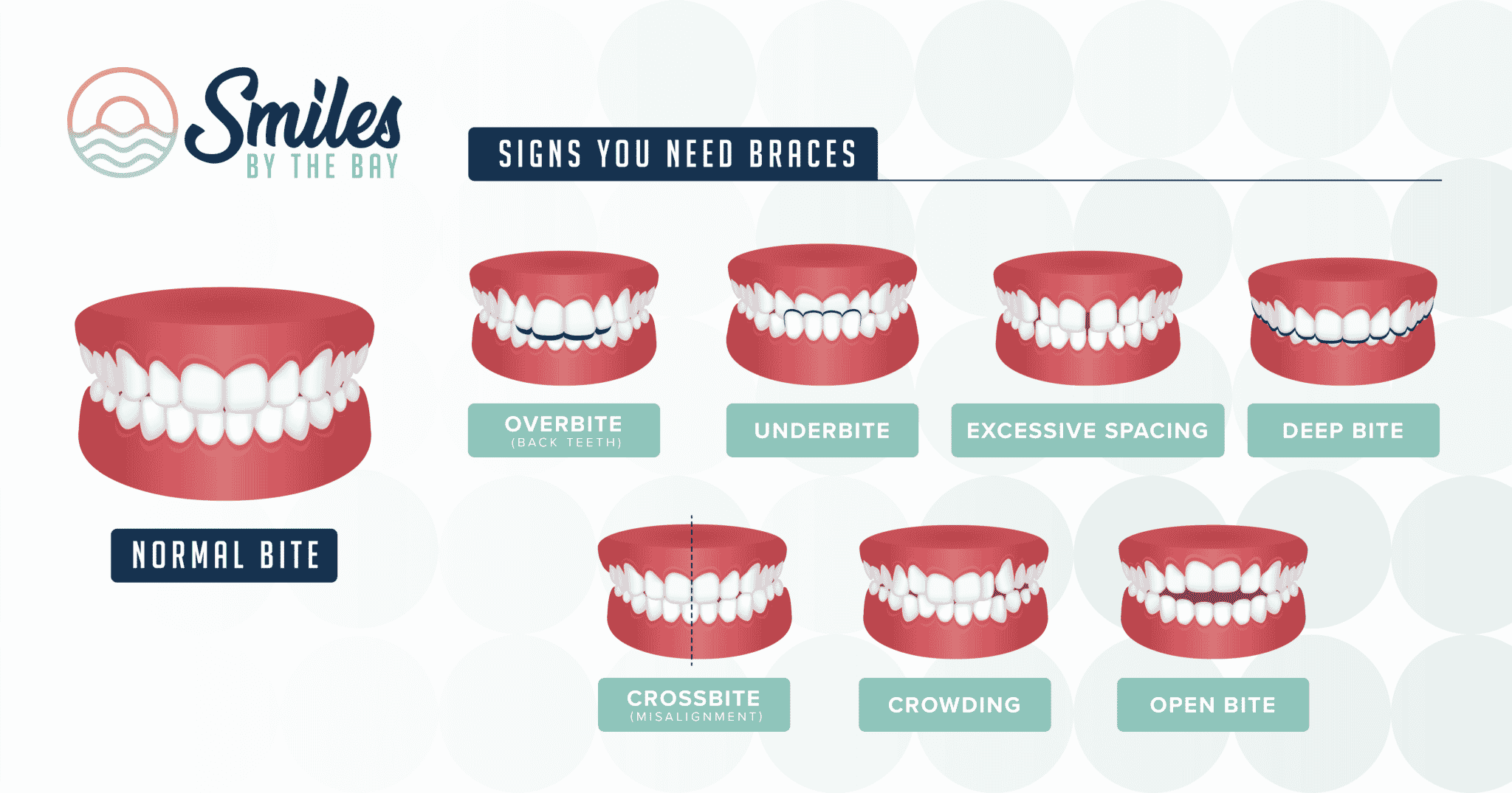 Example Pictures of Misaligned Teeth